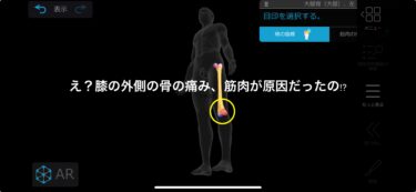 【膝の横の出っ張りが痛い？】Mytrexで大腿骨顆部をセルフケアしたら一瞬で軽くなった話
